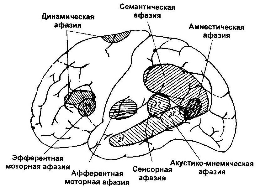 Участки мозга отвечающие за речевые функции. 