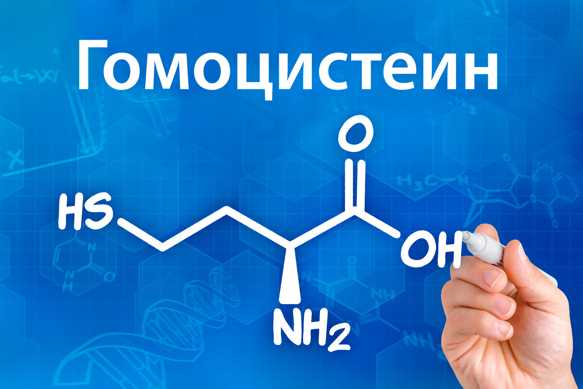 https://proautism.info/homocysteine/
