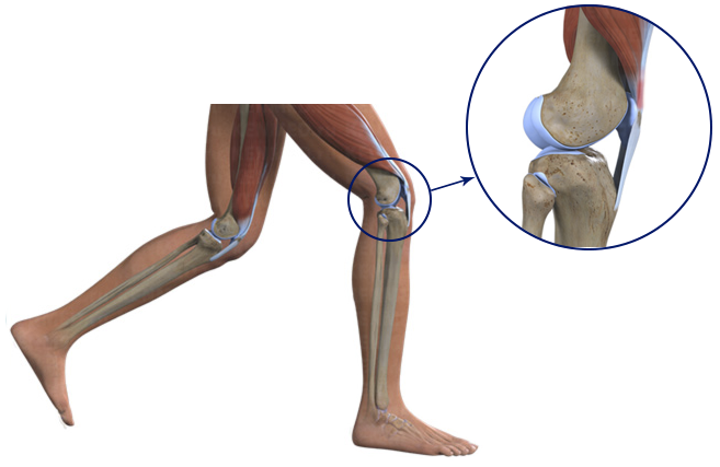 Tендинит коленного сустава: диагностика, симптомы и лечение