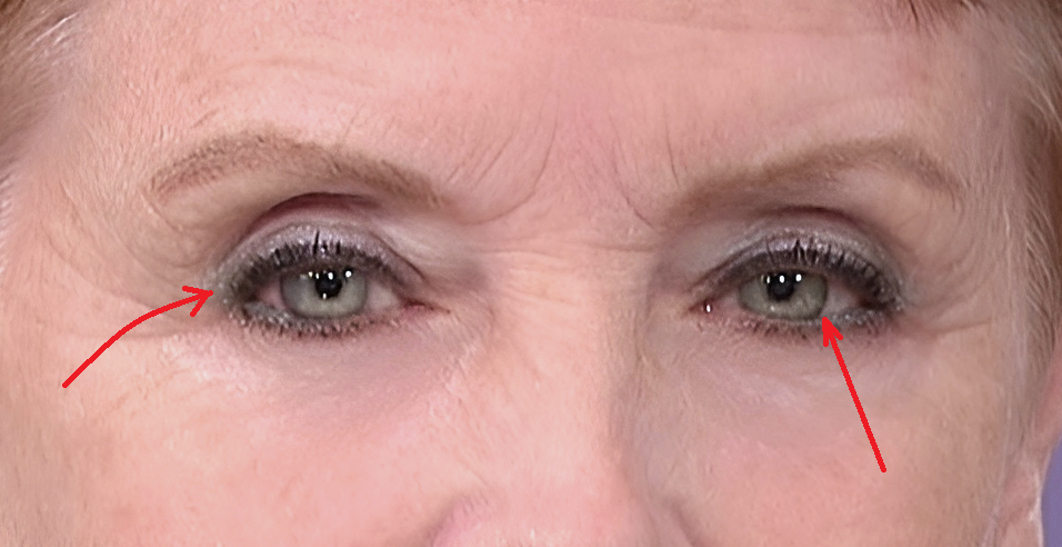 Что вызывает покраснение глаз?