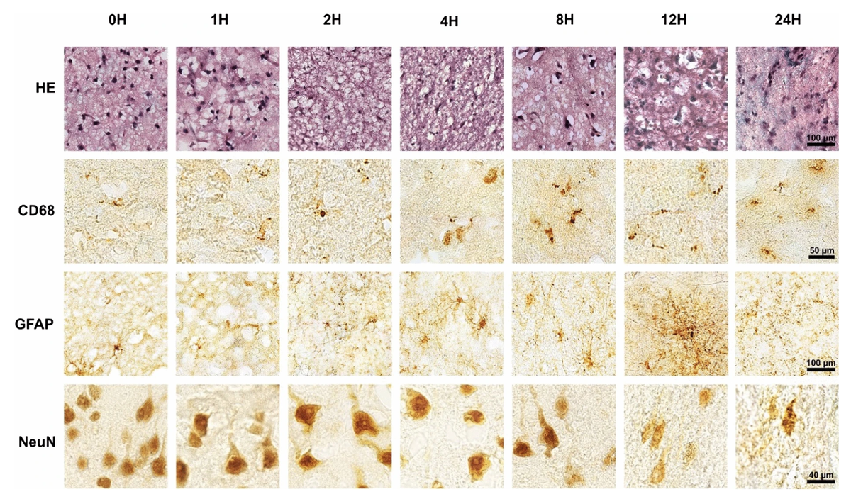 Изображение демонстрирует изменения в нервных тканях во время исследования. Источник: https://www.nature.com/