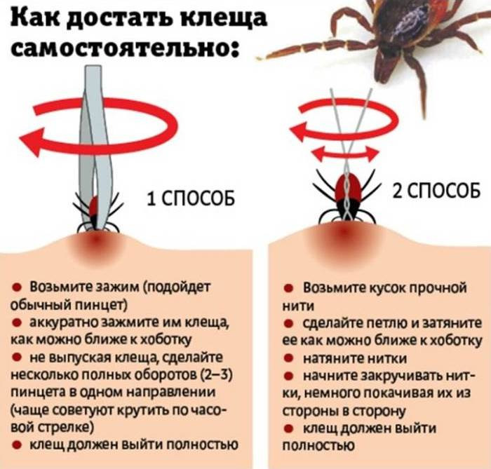 Что делать, если присосался клещ?