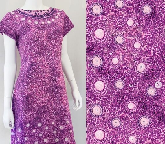 "Платье демонстрирует красоту женской репродуктивной системы" Фото инстаграм @shenovafashion