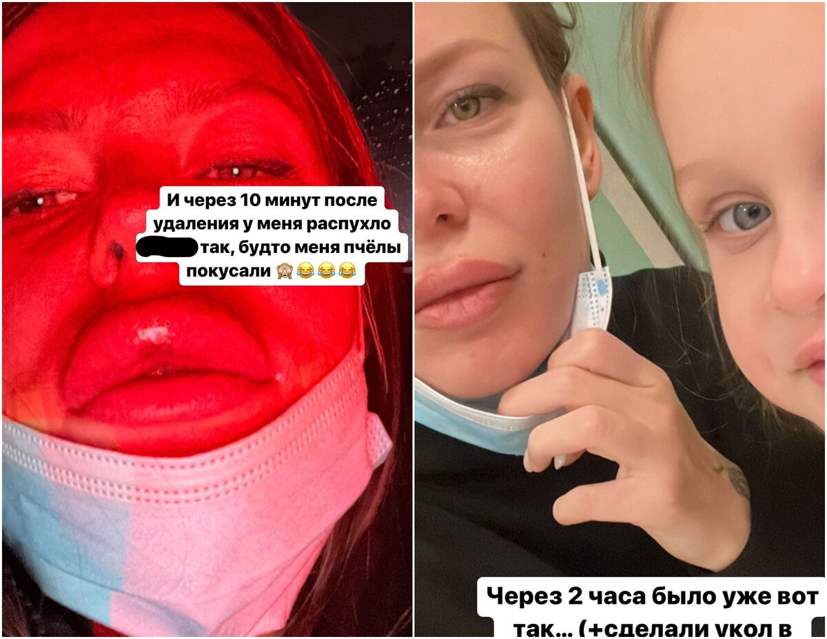    Рита вернула свои натуральные губыСоцсети Риты Дакоты