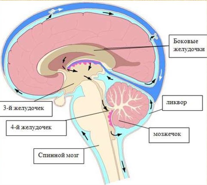 Гидроцефалия головного мозга (водянка) - что это такое, лечение, симптомы, причины