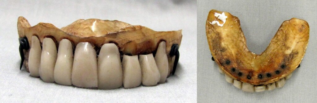 Зубные протезы в древности. Картинка взята из источника: http://www.avantyra.com/upload/medialibrary/6f7/6f7c4cc8bae255489bd7e518b7857d57.jpg.