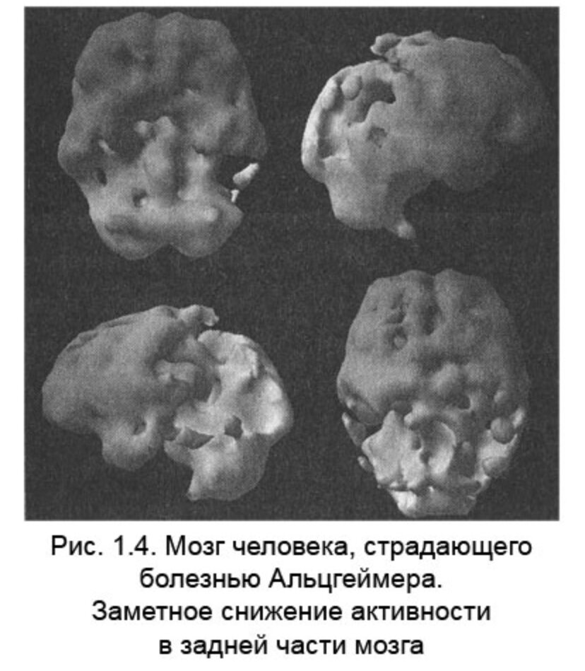 Изменится мозг изменится тело. Сканы мозгов. Измени мозг изменится и тело. Сканы мозга музыкантов. Амен измени свой мозг.