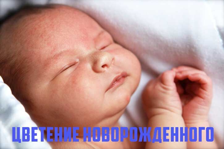 Цветение новорожденного, что это?