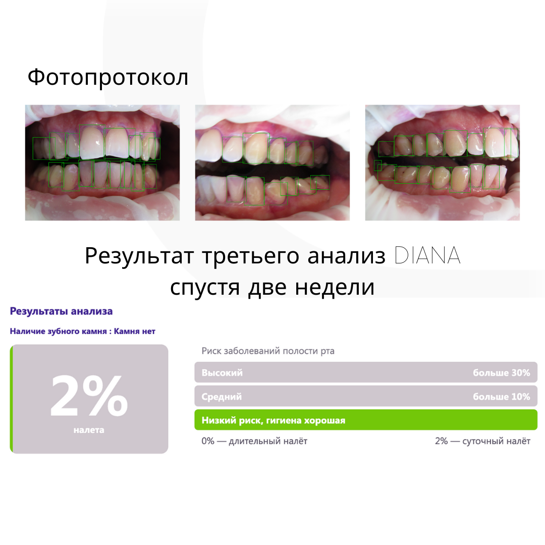 Искусственный интеллект в стоматологии | DIANA | Программа для стоматологов  | Дзен