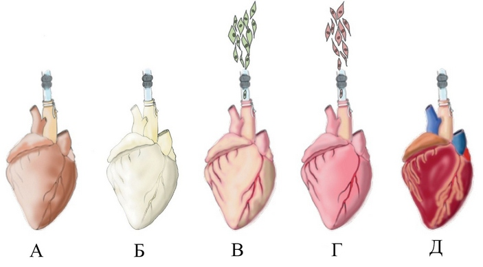 Этапы создания биоискусственного сердца с помощью перфузии, введения веществ через сосудистую сеть. А, Б — децеллюляризация, B, Г — рецеллюляризация: В — заполнение каркаса клетками эндотелия, они в организме выстилают внутреннюю поверхность кровеносных сосудов и полостей сердца, Г — заселение клетками сердца (неонатальными кардиомиоцитами), Д — функциональное сердце. Рисунок из статьи C. Gálvez-Montón et al., 2013. Cardiac tissue engineering and the bioartificial heart, с изменениями