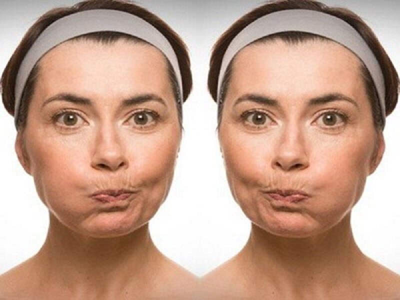 Как подтянуть овал лица без операции и косметолога | Искусство Быть  Женщиной | Дзен