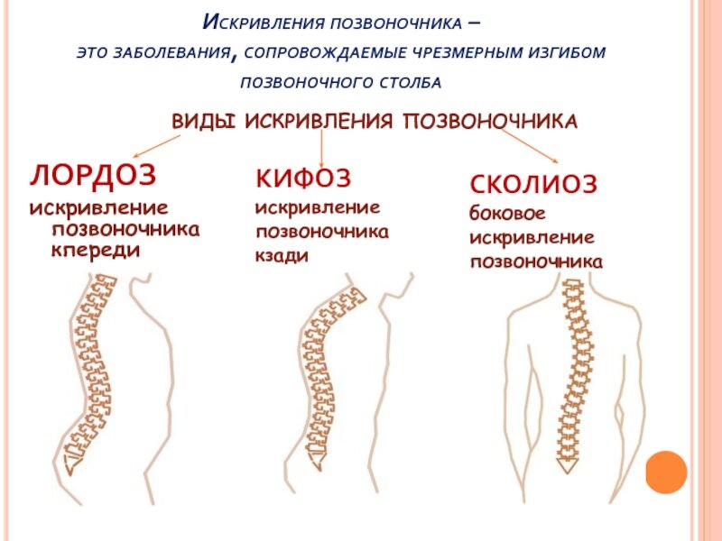 Естественные изгибы позвоночника.