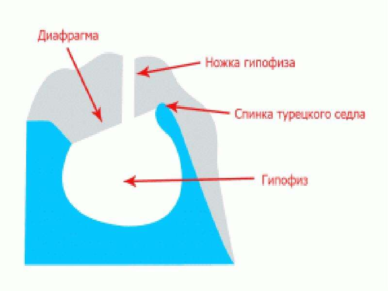 Мембрана турецкого седла анатомия. Диафрагма турецкого седла анатомия. Диафрагма турецкого седла. Диафрагма седла.