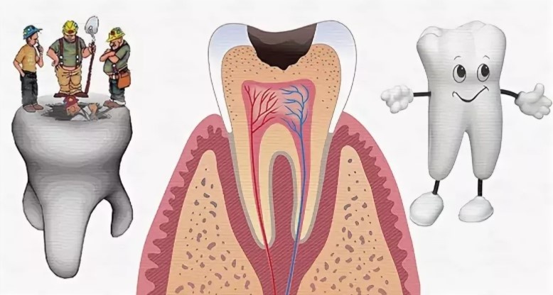 Как правильно проводить профилактику кариеса?