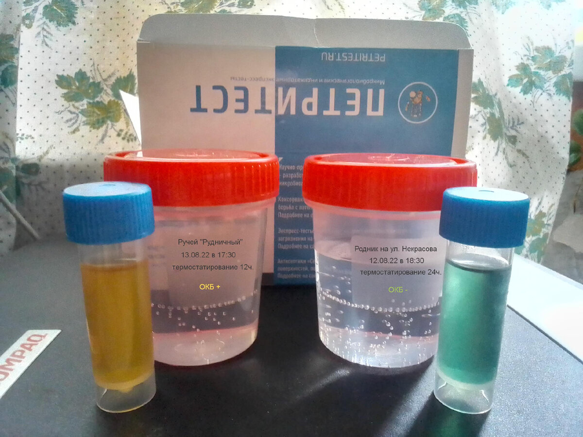 Желтая окраска среды Кода означает положительную реакцию (ОКБ)
