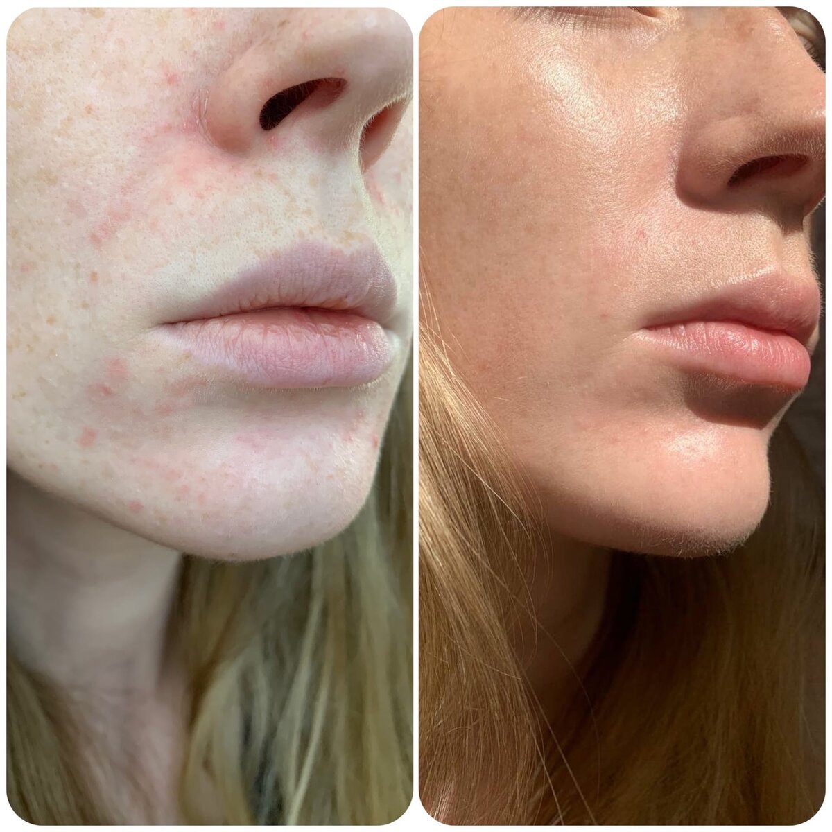 Все фото автора канала BogemaBeauty.