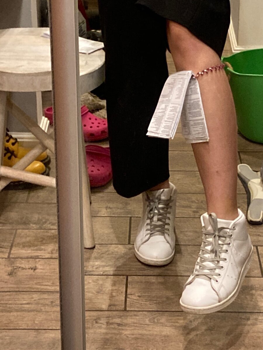 Шпора на ноге