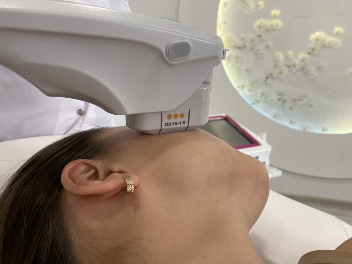 SMAS-lifting обучение