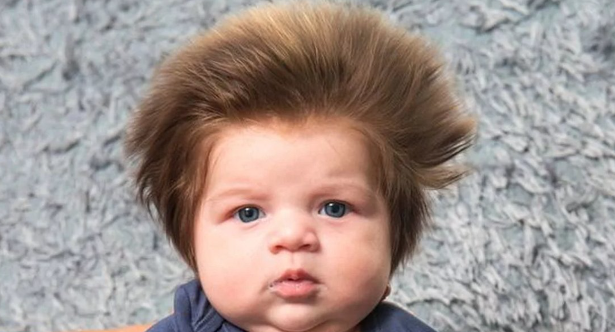 Могут ли дети родиться с волосами. Бейби Хэир. Мальчик одуванчик. Ребенок с взъерошенными волосами. Мальчик волосы много.