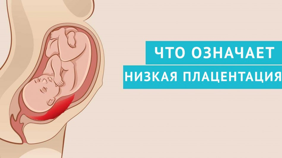 беременность ребенок низко расположен
