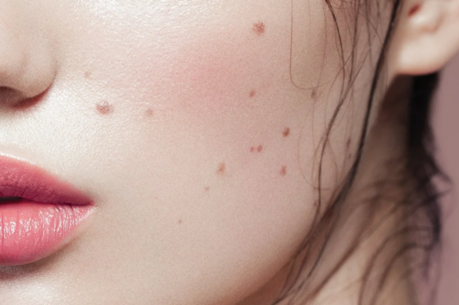 Фото взято из открытых источников