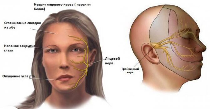 Тройничный нерв лечение