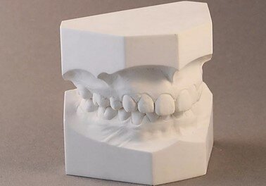 Гипсы для стоматологии
