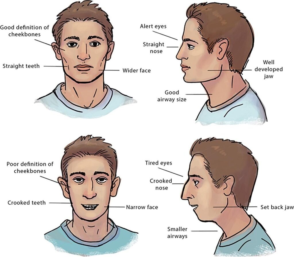 Красивая форма мужского лица. Упражнения для челюсти и скул. Как оформить  бороду | Доктор Ярослав Конышков | Дзен