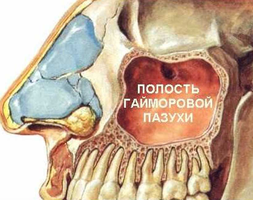 Боль в челюсти