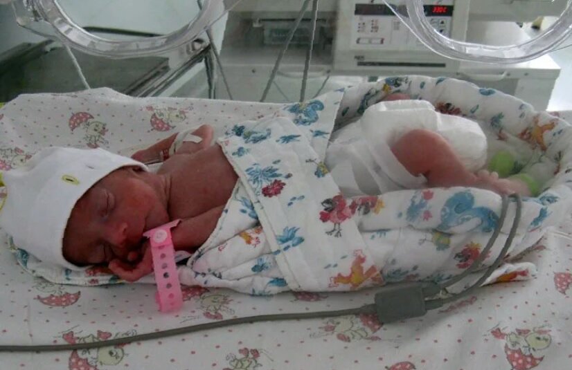 Недоношенный малыш в кювезе