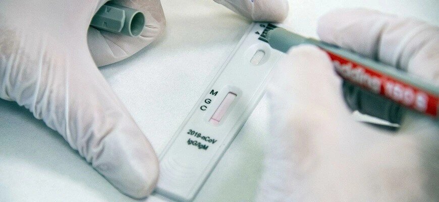 Экспресс-тест на антитела к коронавирусу, © Евгений Биятов / РИА Новости