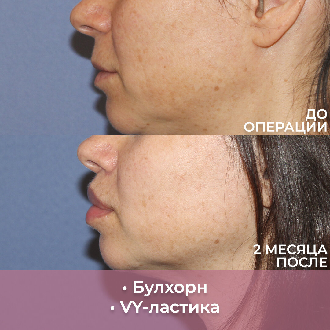 Пластический хирург: Левицкая М.Г.