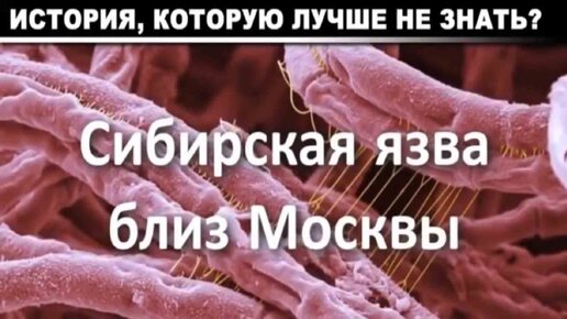 Сибирская язва близ Москвы