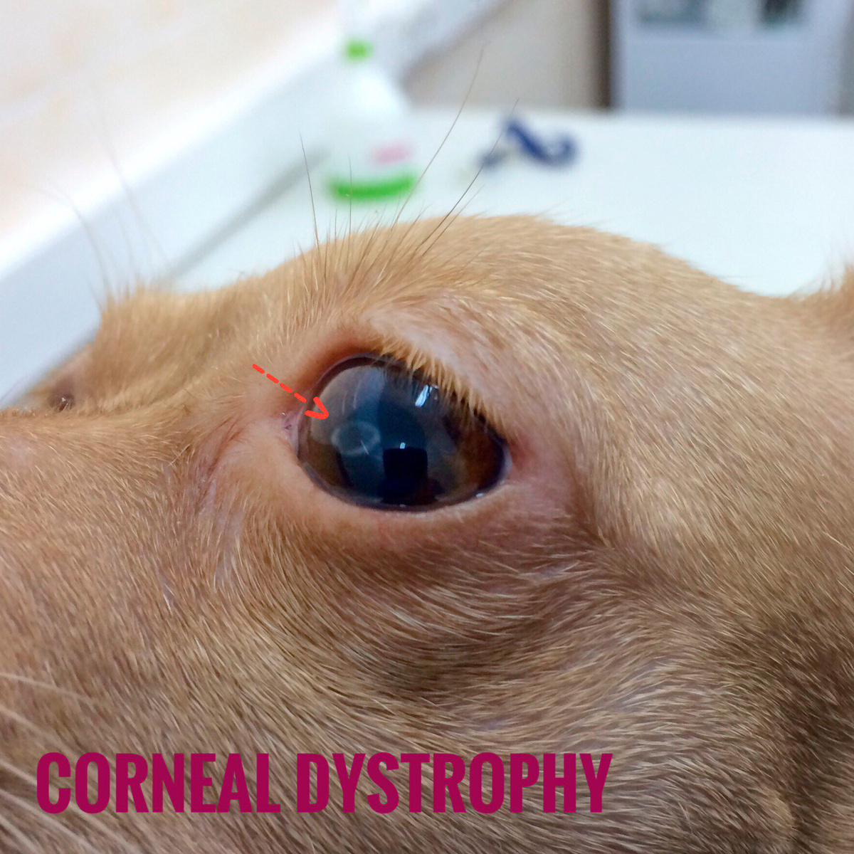 Дистрофия роговицы