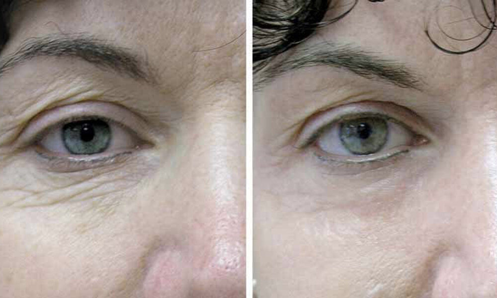 фото из поисковой системы