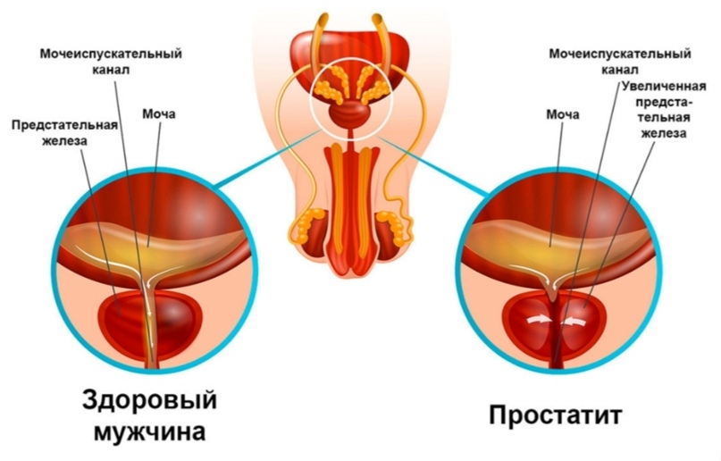 Сперма не выстреливает. Стоит ли паниковать?