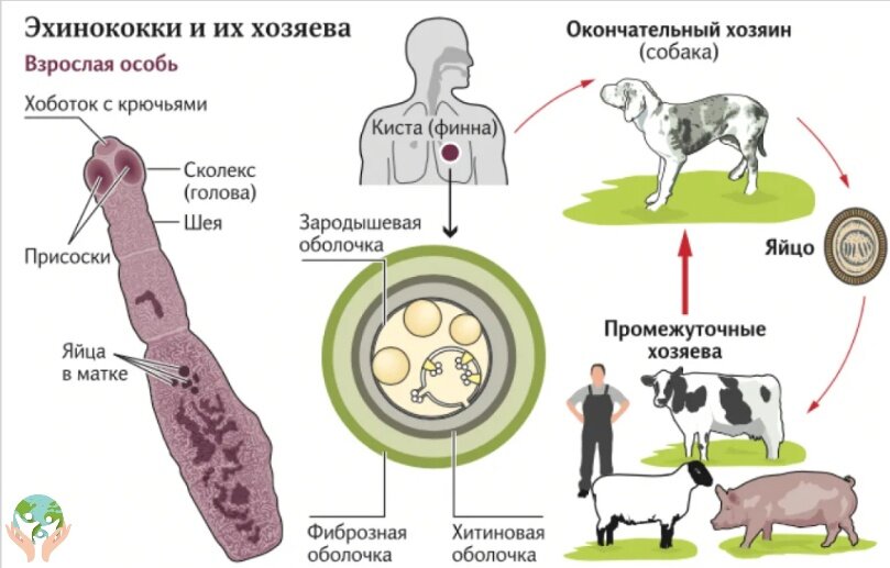Эхинококкоз у ребенка: профилактика и лечение
