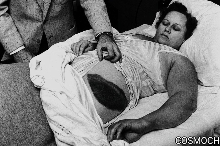 Энн Ходжес. Синяк от метеорита.(изображение из Jay Leviton/The LIFE Images Collection/Getty Images)