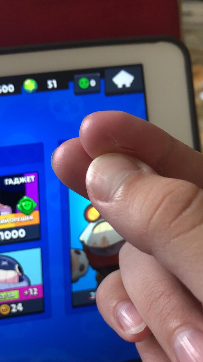 Сильно  царапнула.. 