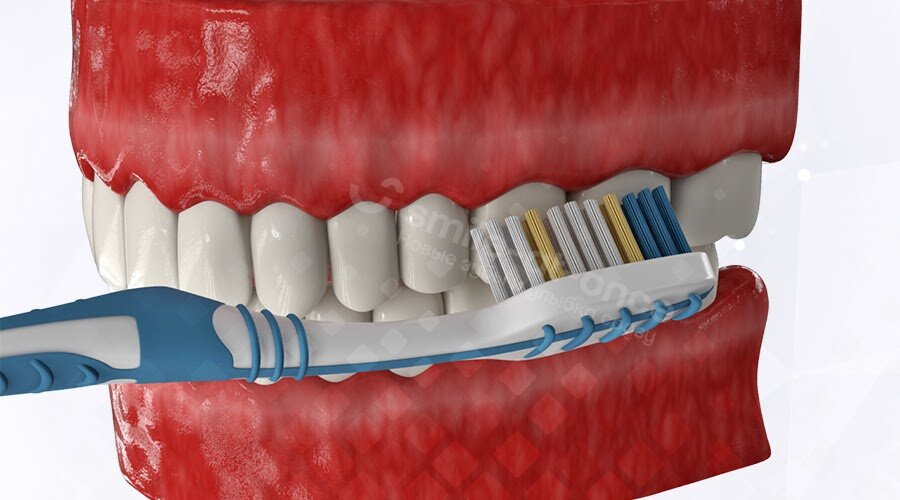 Движения щеткой нужно выполнять правильно. Основной смысл – чистить «от красного к белому», от десны к краям зубов. Фото: Smile-at-Once.ru.