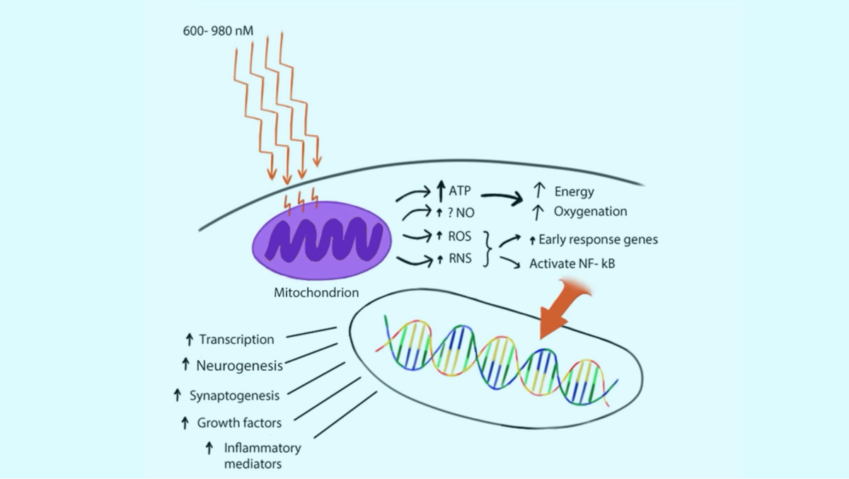 Схема взята из исследования" влияние инфракрасного света на реабилитацию пациентов после травмы головного мозга."