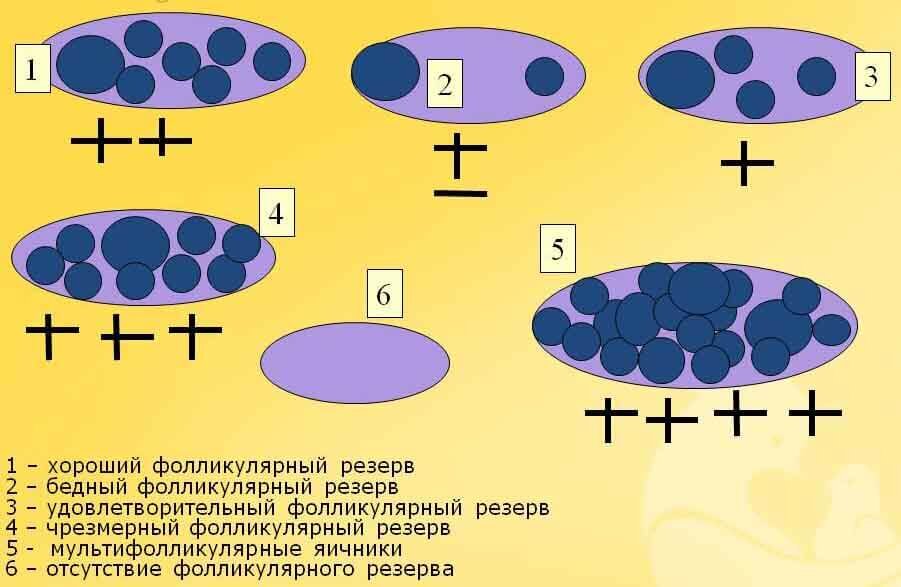 ЭКО и низкий овариальный резерв