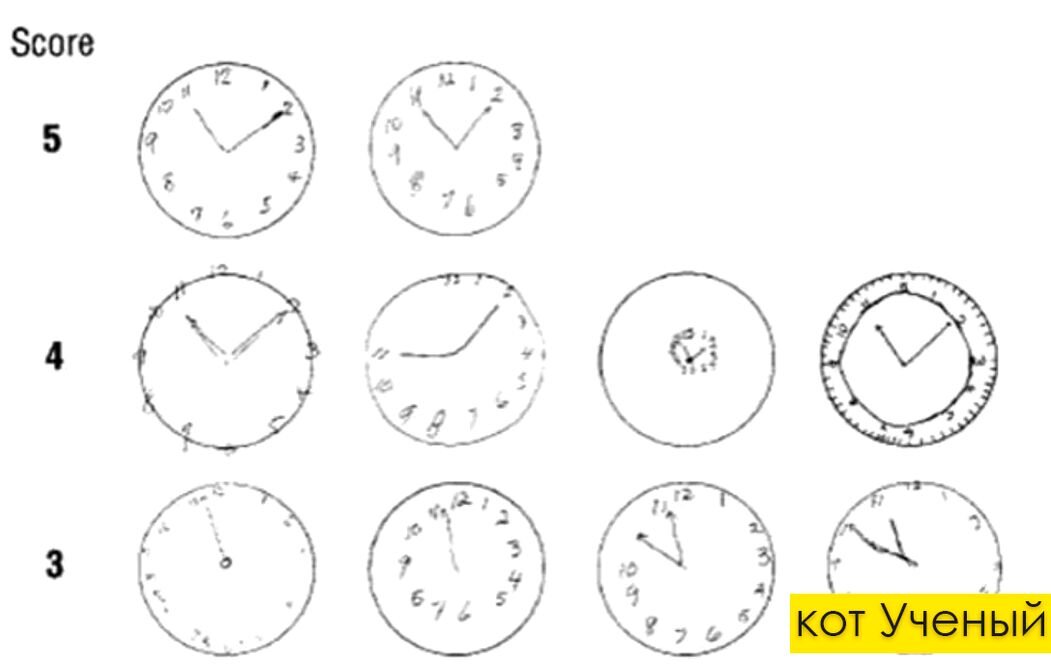 Тест рисования часов. Тест рисования часов при деменции. Тест на деменцию нарисовать часы. Тест рисования часов при болезни Альцгеймера.