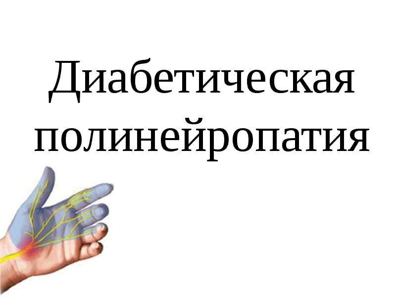 Диабетическая полинейропатия неврология презентация