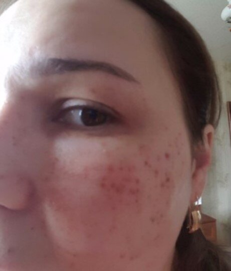 Фотографии результатов ДО и ПОСЛЕ