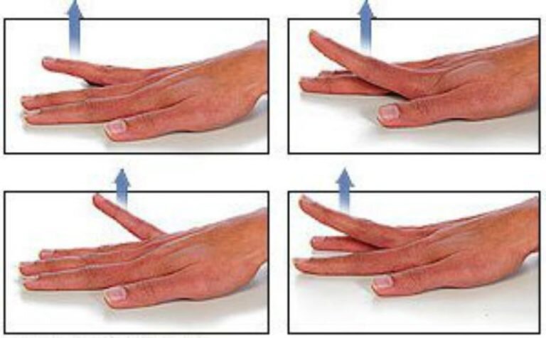 Как восстановить палец после. Зарядка для кистей рук и пальцев при ревматоидном артрите. Упражнения реабилитации после инсульта для кисти руки. ЛФК при ревматоидном артрите кистей рук и пальцев. Упражнения для разработки запястья.
