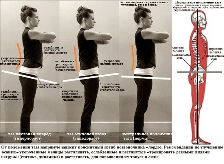 В каком положении стоят. Правильное положение таза. Передний наклон таза. Правильно положение таща. Мышцы осанки.