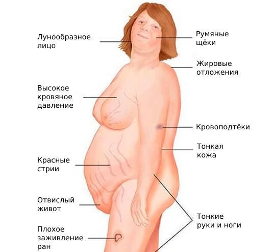 Гиперандрогения