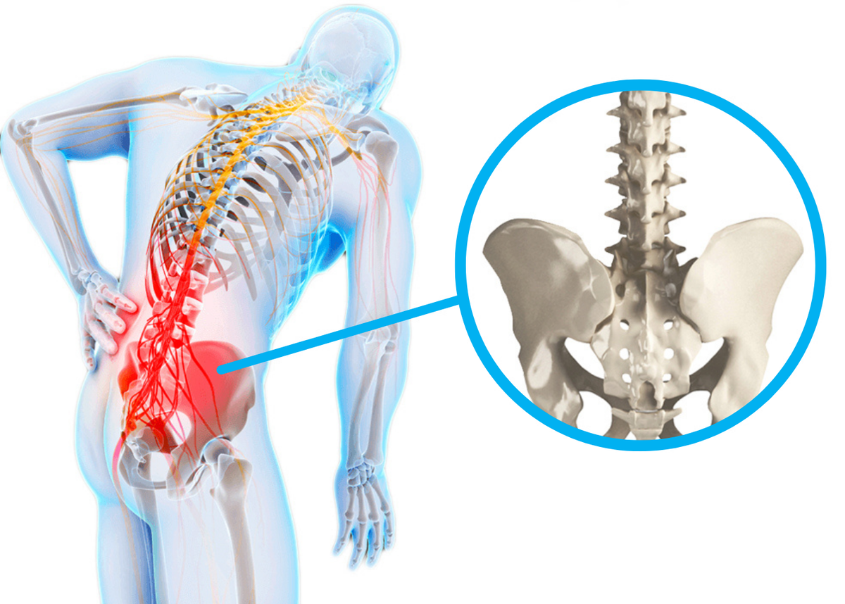 Продула поясницу боли. Пояснично-крестцовый отдел позвоночника. Люмбаго поясничного отдела позвоночника симптомы. Поясцово-крестцовый отдел позвоночника. Люмбалгия поясничного крестцового отдела.