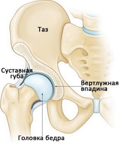 Врожденная дисплазия тазобедренного сустава